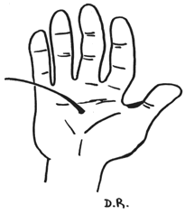 Avoir un poil dans la main